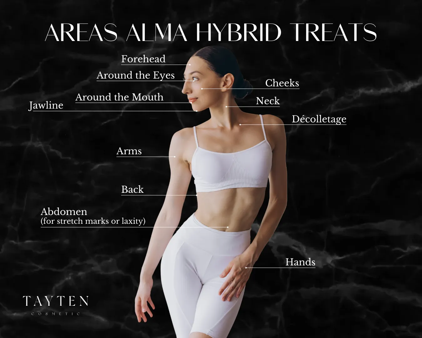 Areas Alma Hybrid treats