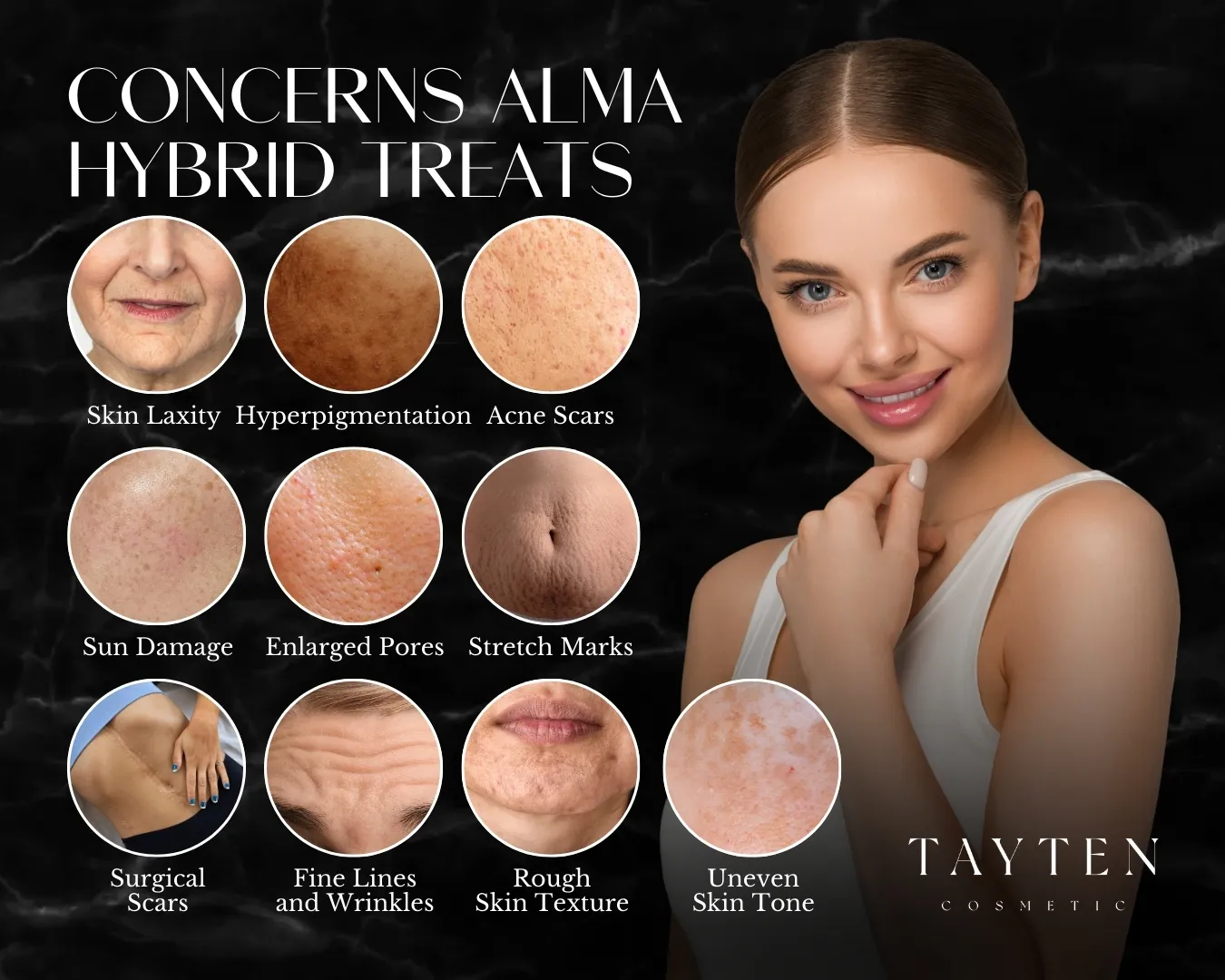 Concerns Alma Hybrid treats